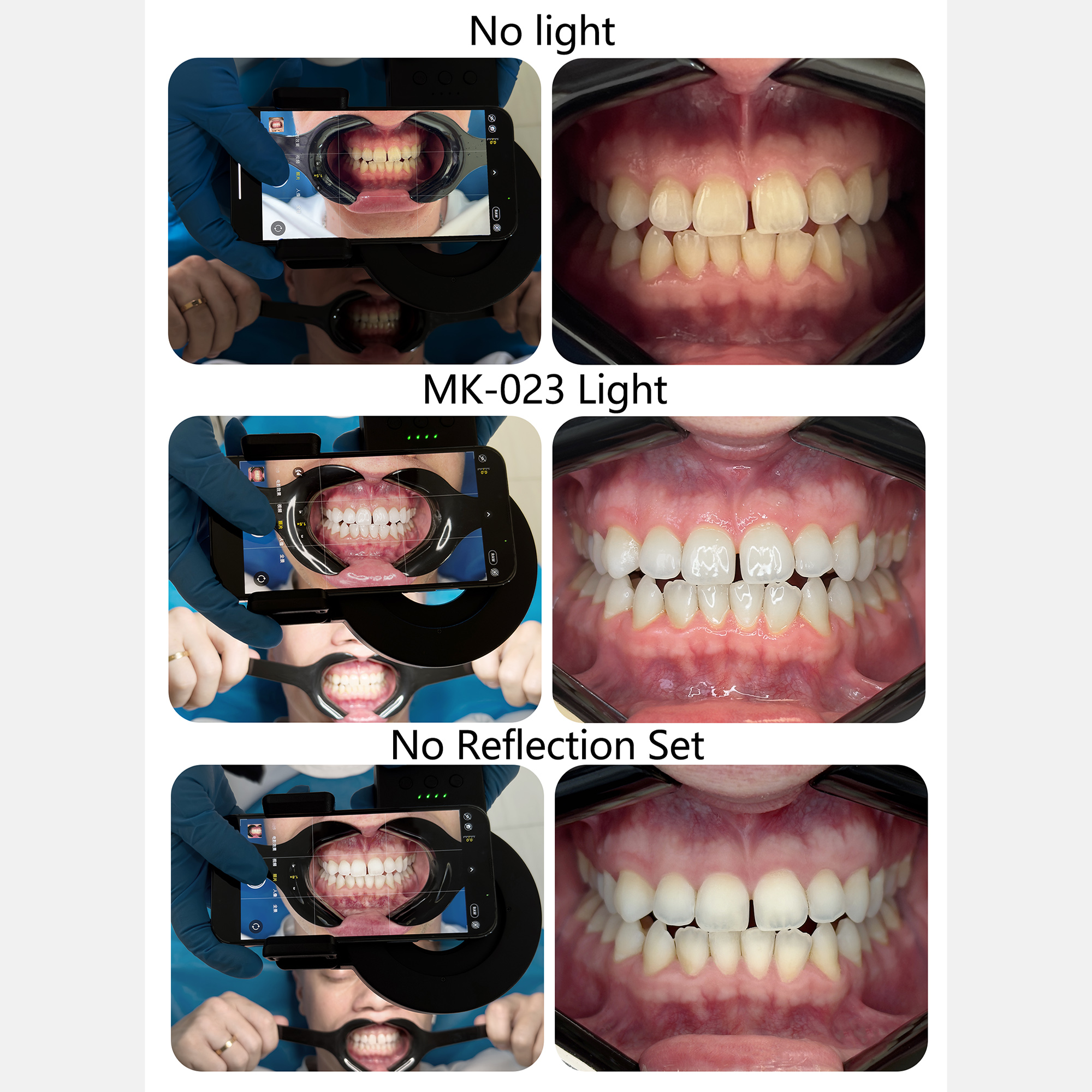 HERA MK-23 Intraoral Dental Ph – Photography Dental recenzja i cena