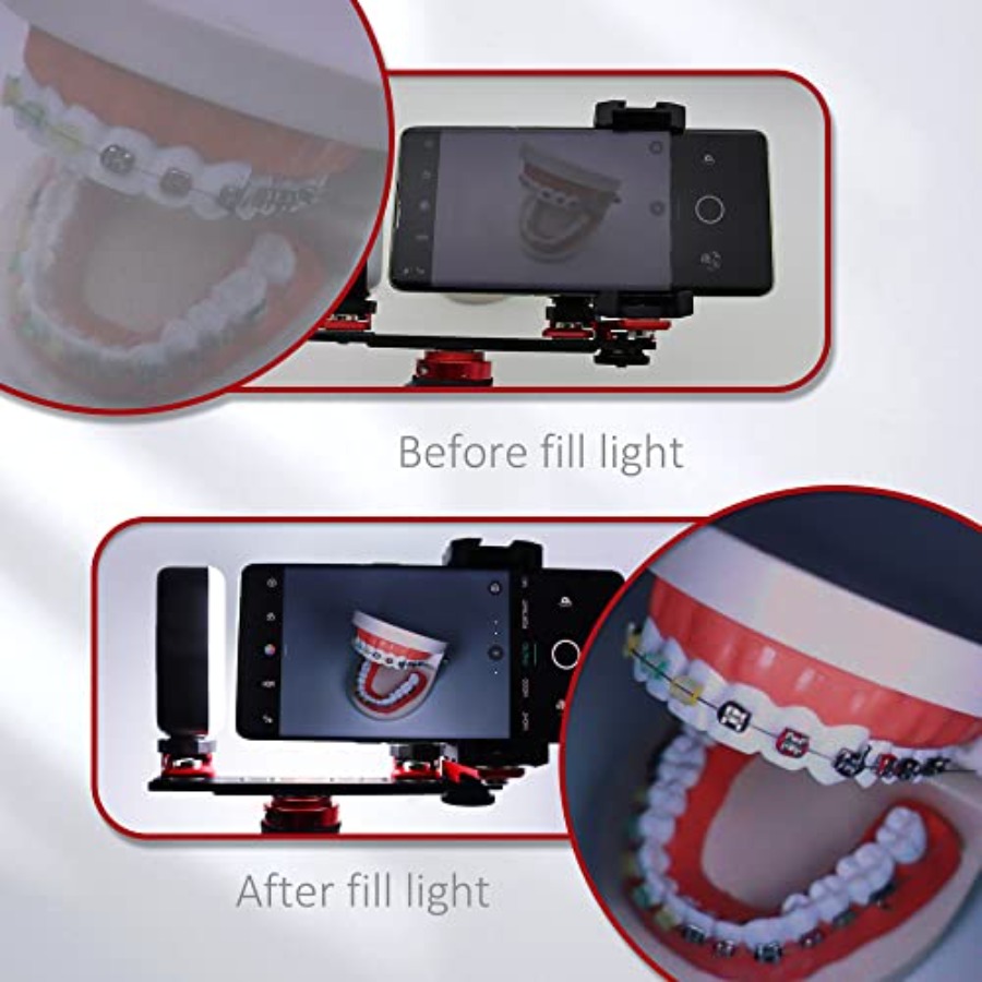 Bluetooth Dental Flash Light P – Photography Dental recenzja i cena