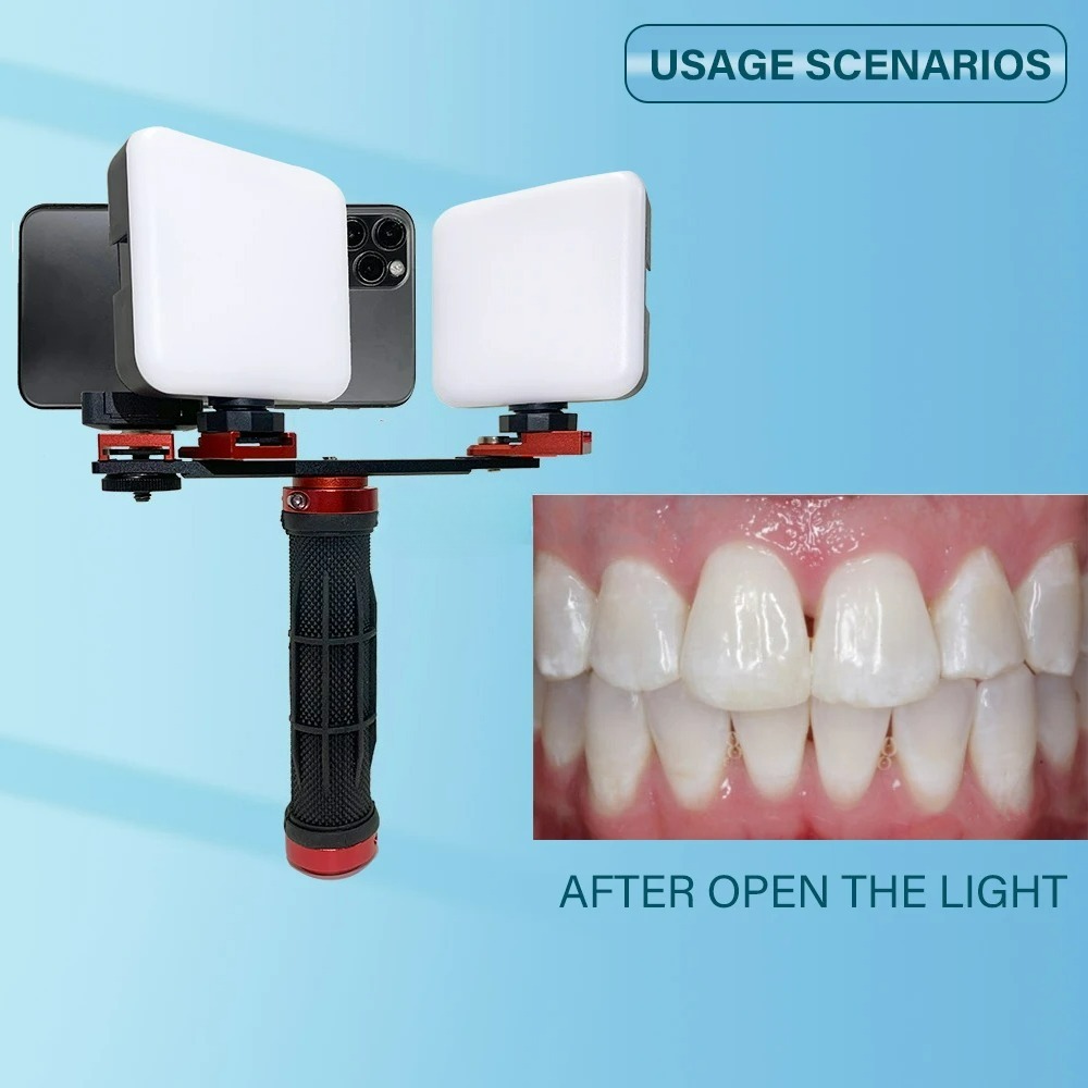 Dental Photography Light Phone – Photography Dental recenzja i cena