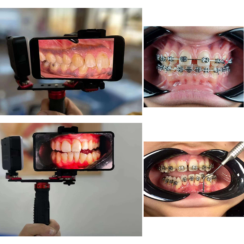 Dentistry Material Mobile Phon – Photography Dental recenzja i cena