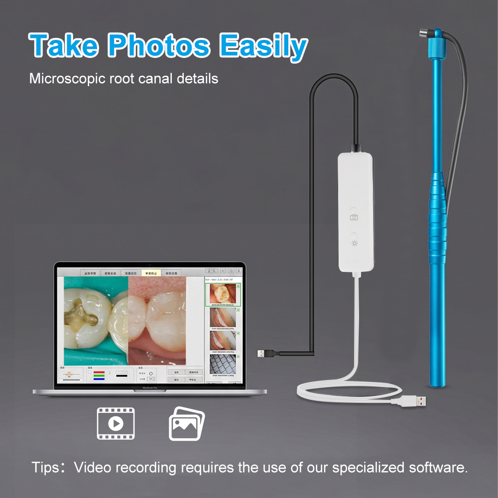 5MP Micro Intraoral Camera Den – Photography Dental recenzja i cena