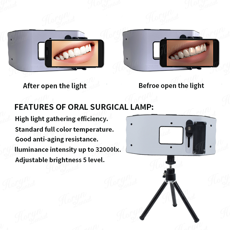 Dental Flash Light Photography – Photography Dental recenzja i cena