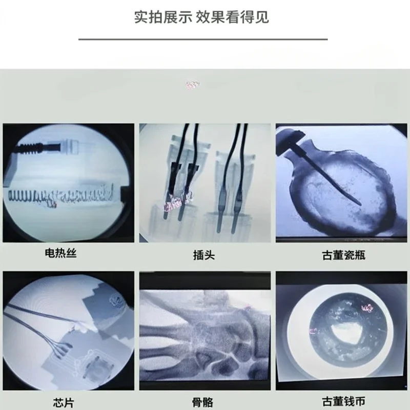 FOR  fluoroscopy machine for l – Photography X Ray recenzja i cena